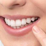 5 Powerful Tips on How to Whiten Teeth Perfectly