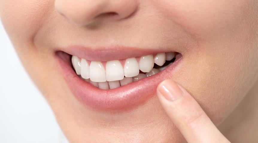 5 Powerful Tips on How to Whiten Teeth Perfectly